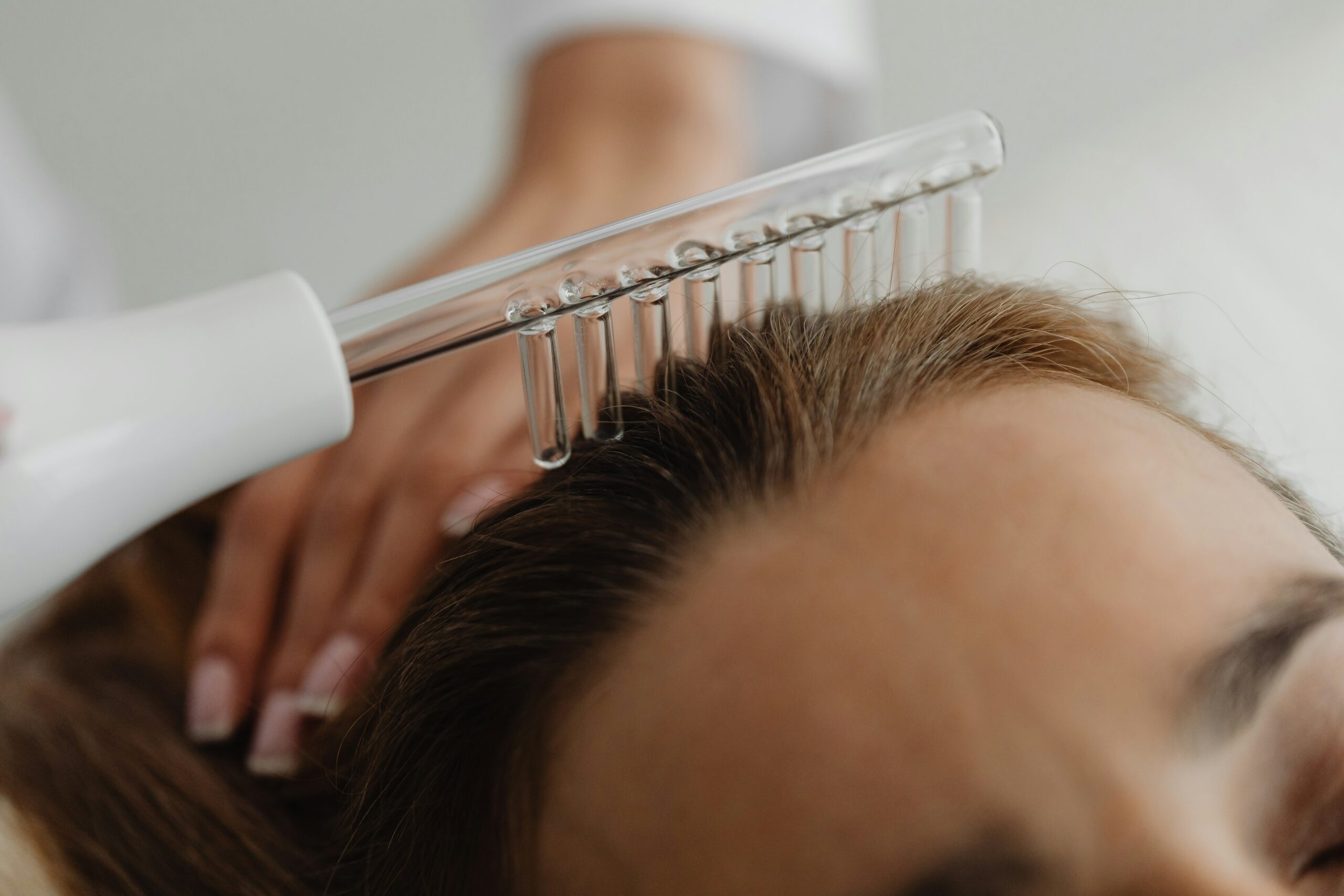 Woman's scalp on treatment